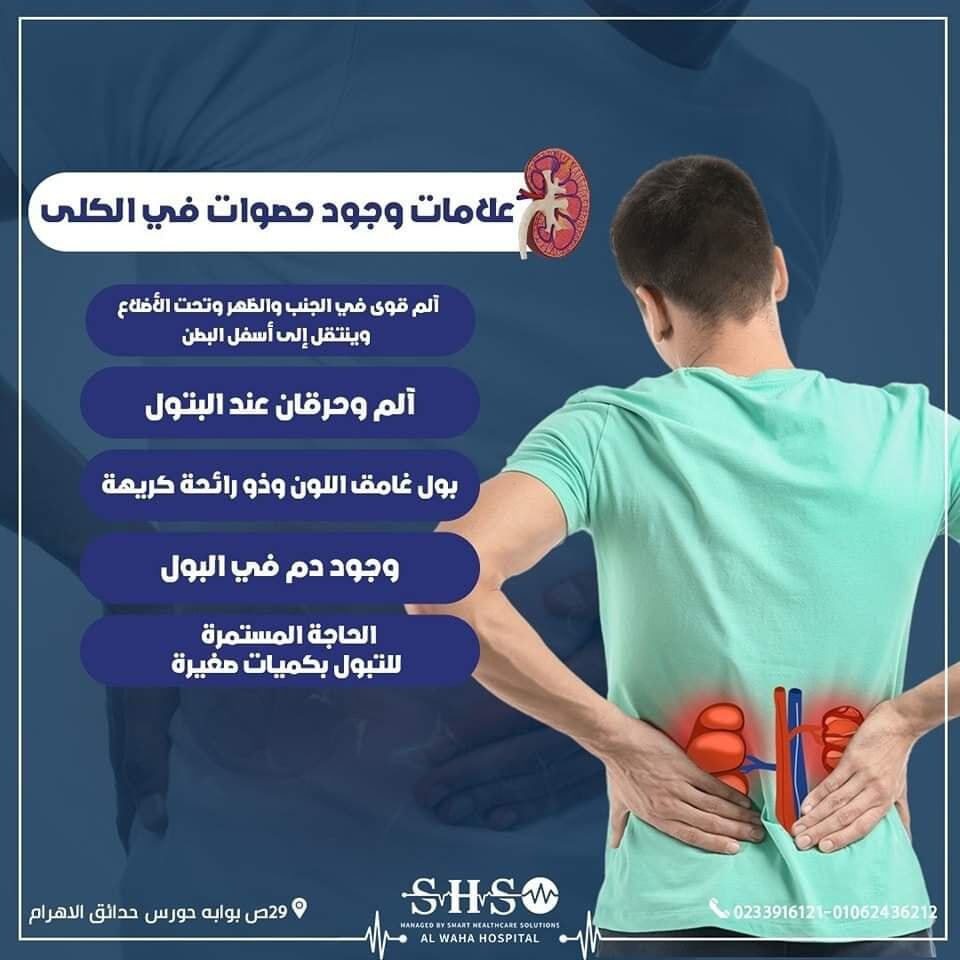 علامات وجود حصوات في الكلي 